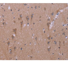 Immunohistochemistry - KCNJ9 Antibody from Signalway Antibody (37594) - Antibodies.com