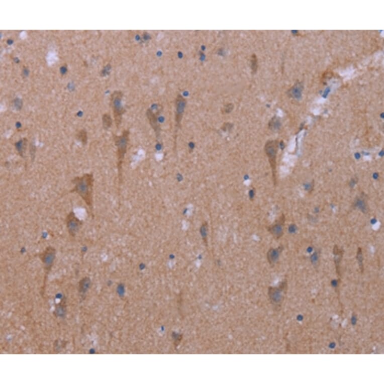 Immunohistochemistry - KCNJ9 Antibody from Signalway Antibody (37594) - Antibodies.com