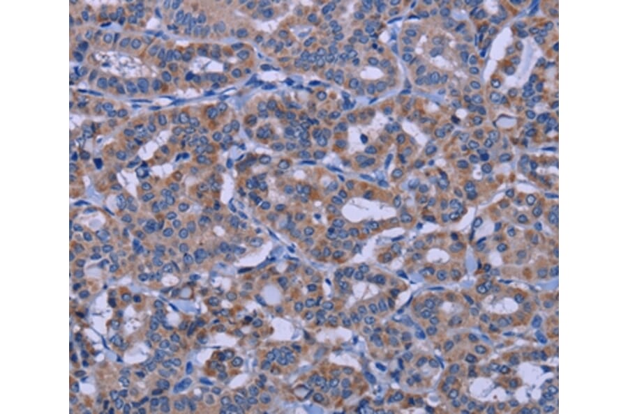Immunohistochemistry - KCNJ9 Antibody from Signalway Antibody (37594) - Antibodies.com
