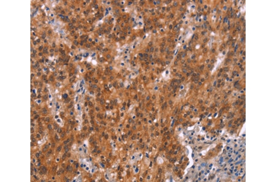 Immunohistochemistry - GNAT3 Antibody from Signalway Antibody (37600) - Antibodies.com