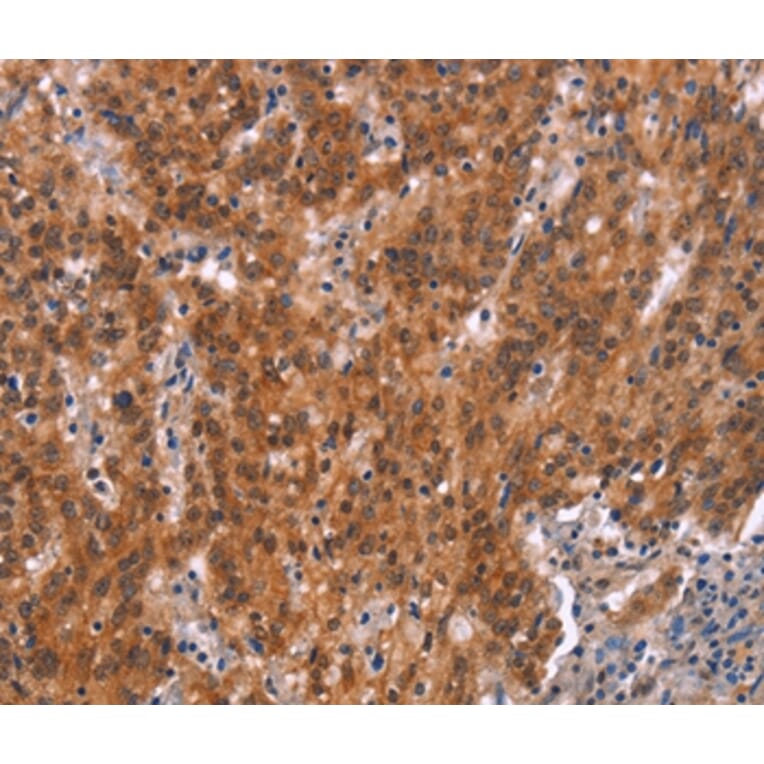 Immunohistochemistry - GNAT3 Antibody from Signalway Antibody (37600) - Antibodies.com