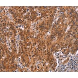 Immunohistochemistry - GNAT3 Antibody from Signalway Antibody (37600) - Antibodies.com