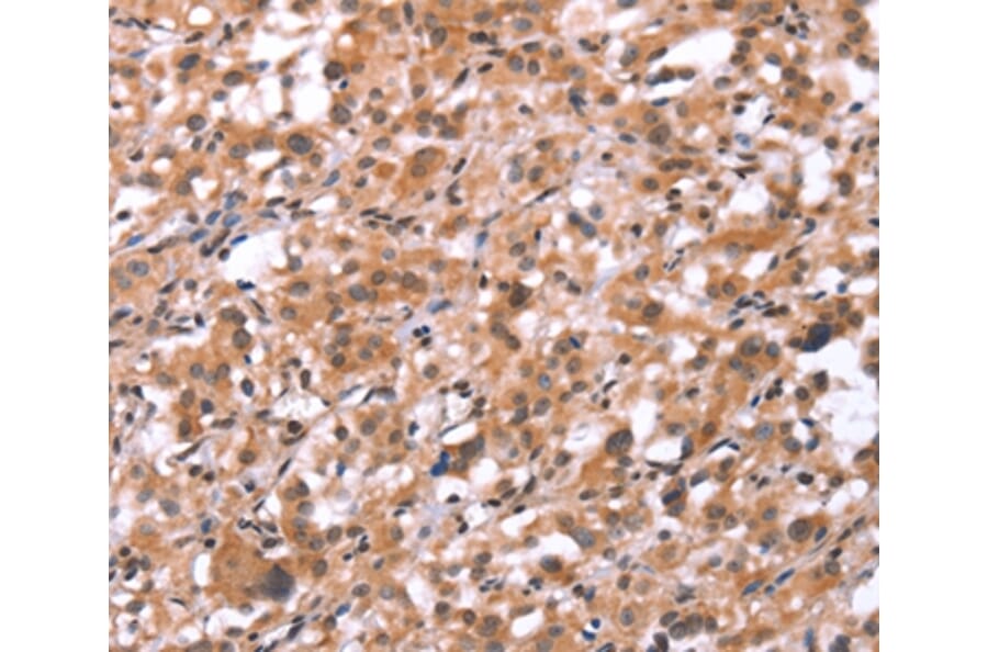 Immunohistochemistry - GNAT3 Antibody from Signalway Antibody (37600) - Antibodies.com