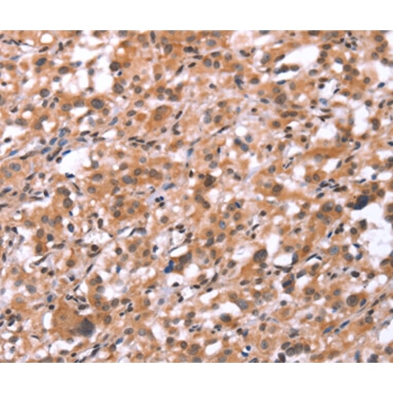 Immunohistochemistry - GNAT3 Antibody from Signalway Antibody (37600) - Antibodies.com