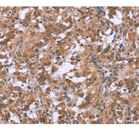 Immunohistochemistry - GNPAT Antibody from Signalway Antibody (37601) - Antibodies.com