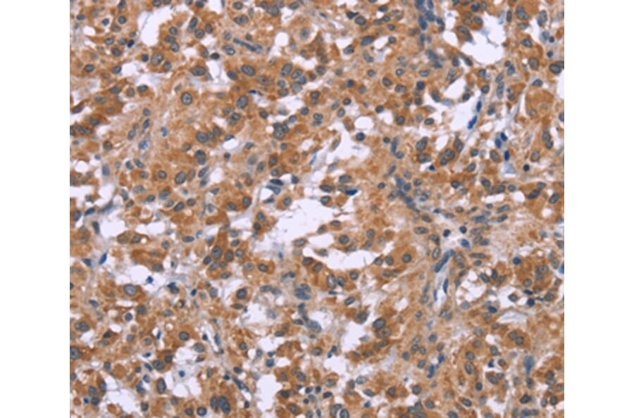 Immunohistochemistry - GNPAT Antibody from Signalway Antibody (37601) - Antibodies.com
