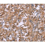 Immunohistochemistry - GNPAT Antibody from Signalway Antibody (37601) - Antibodies.com