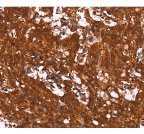 Immunohistochemistry - HCAR2 Antibody from Signalway Antibody (37602) - Antibodies.com