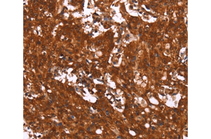 Immunohistochemistry - HCAR2 Antibody from Signalway Antibody (37602) - Antibodies.com