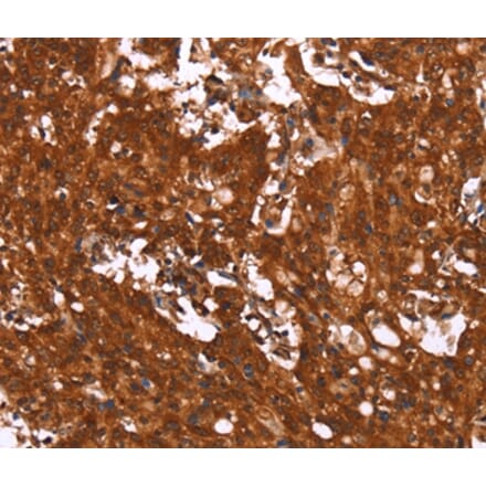 Immunohistochemistry - HCAR2 Antibody from Signalway Antibody (37602) - Antibodies.com