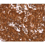 Immunohistochemistry - HCAR2 Antibody from Signalway Antibody (37602) - Antibodies.com