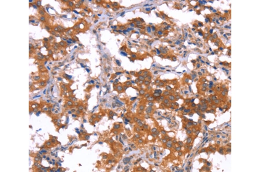 Immunohistochemistry - HCAR2 Antibody from Signalway Antibody (37602) - Antibodies.com