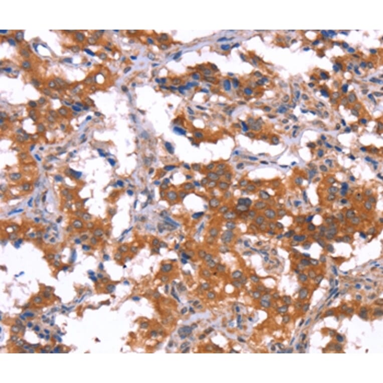 Immunohistochemistry - HCAR2 Antibody from Signalway Antibody (37602) - Antibodies.com