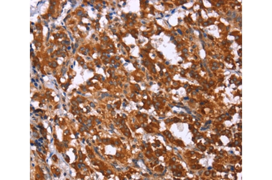 Immunohistochemistry - GPR65 Antibody from Signalway Antibody (37608) - Antibodies.com