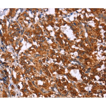 Immunohistochemistry - GPR65 Antibody from Signalway Antibody (37608) - Antibodies.com