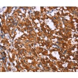 Immunohistochemistry - GPR65 Antibody from Signalway Antibody (37608) - Antibodies.com