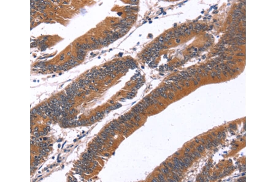 Immunohistochemistry - GREB1 Antibody from Signalway Antibody (37610) - Antibodies.com