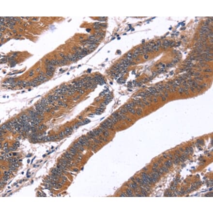 Immunohistochemistry - GREB1 Antibody from Signalway Antibody (37610) - Antibodies.com