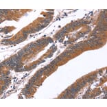 Immunohistochemistry - GREB1 Antibody from Signalway Antibody (37610) - Antibodies.com