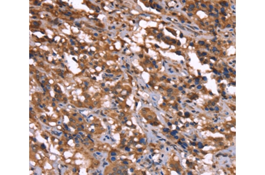 Immunohistochemistry - GREB1 Antibody from Signalway Antibody (37610) - Antibodies.com