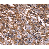 Immunohistochemistry - GREB1 Antibody from Signalway Antibody (37610) - Antibodies.com