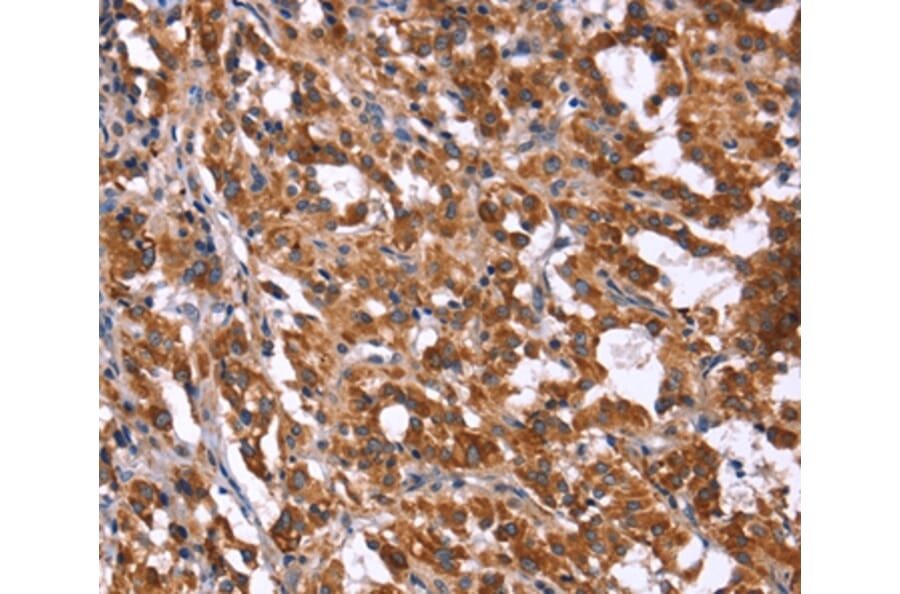 Immunohistochemistry - HACE1 Antibody from Signalway Antibody (37612) - Antibodies.com