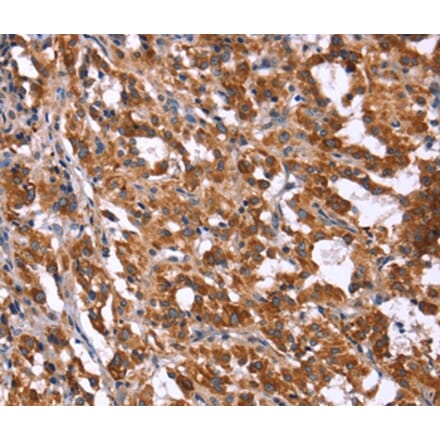 Immunohistochemistry - HACE1 Antibody from Signalway Antibody (37612) - Antibodies.com