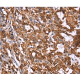 Immunohistochemistry - HACE1 Antibody from Signalway Antibody (37612) - Antibodies.com