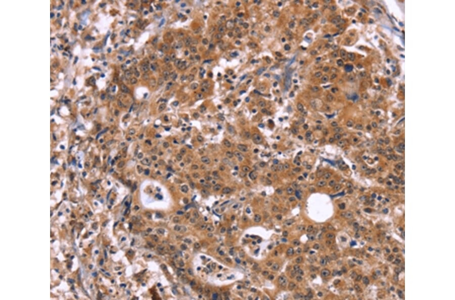 Immunohistochemistry - HACE1 Antibody from Signalway Antibody (37612) - Antibodies.com