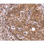 Immunohistochemistry - HACE1 Antibody from Signalway Antibody (37612) - Antibodies.com