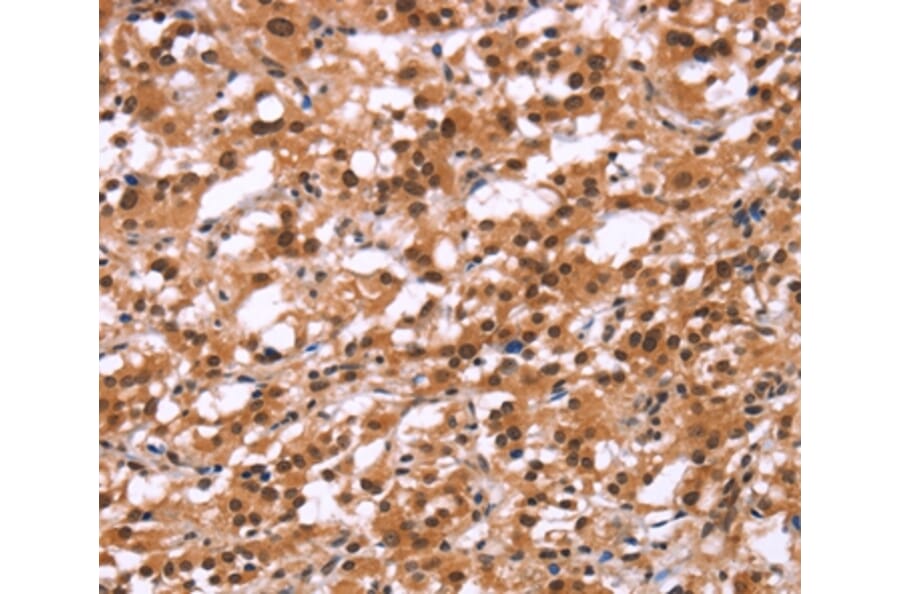 Immunohistochemistry - HIPK1 Antibody from Signalway Antibody (37619) - Antibodies.com
