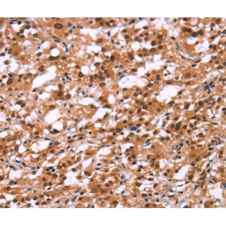 Immunohistochemistry - HIPK1 Antibody from Signalway Antibody (37619) - Antibodies.com