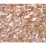 Immunohistochemistry - HIPK1 Antibody from Signalway Antibody (37619) - Antibodies.com