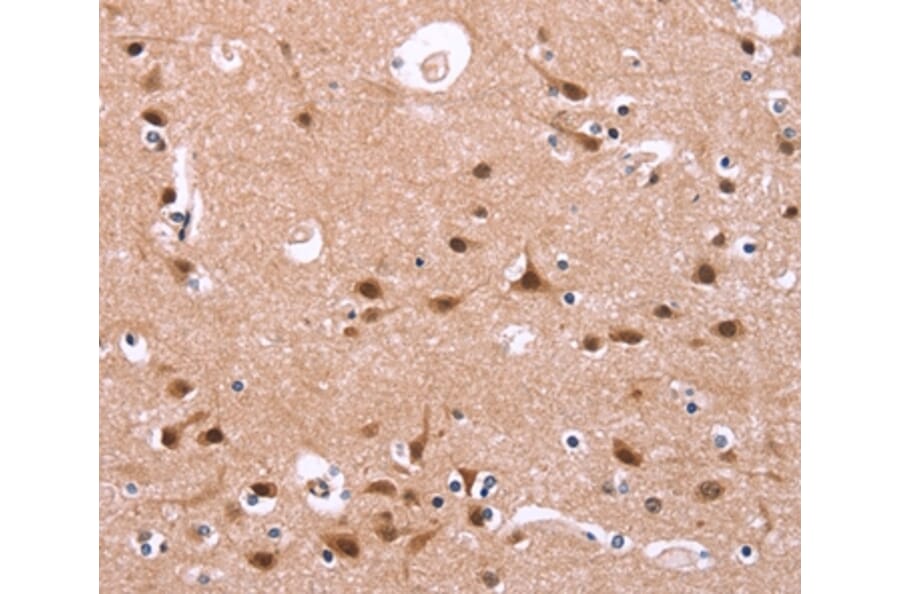 Immunohistochemistry - HIPK1 Antibody from Signalway Antibody (37619) - Antibodies.com
