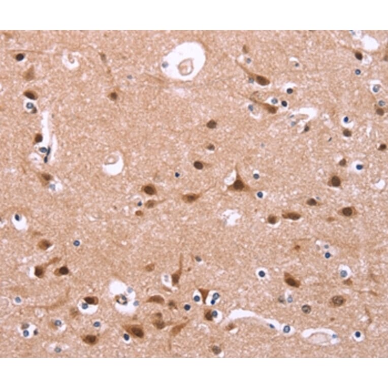 Immunohistochemistry - HIPK1 Antibody from Signalway Antibody (37619) - Antibodies.com
