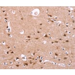Immunohistochemistry - HIPK1 Antibody from Signalway Antibody (37619) - Antibodies.com