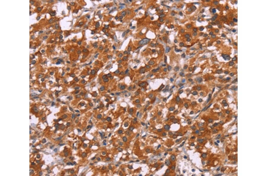 Immunohistochemistry - HSPB6 Antibody from Signalway Antibody (37637) - Antibodies.com