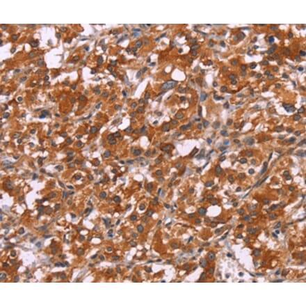 Immunohistochemistry - HSPB6 Antibody from Signalway Antibody (37637) - Antibodies.com