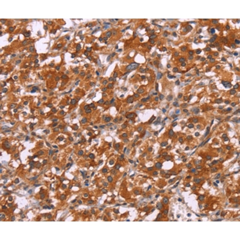 Immunohistochemistry - HSPB6 Antibody from Signalway Antibody (37637) - Antibodies.com