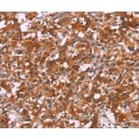 Immunohistochemistry - HSPB6 Antibody from Signalway Antibody (37637) - Antibodies.com