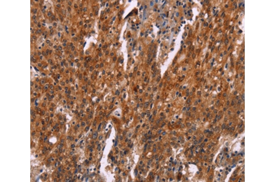 Immunohistochemistry - HSPB6 Antibody from Signalway Antibody (37637) - Antibodies.com