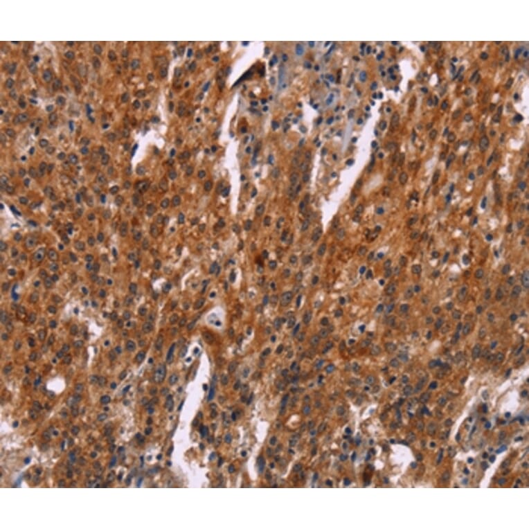 Immunohistochemistry - HSPB6 Antibody from Signalway Antibody (37637) - Antibodies.com