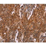 Immunohistochemistry - HSPB6 Antibody from Signalway Antibody (37637) - Antibodies.com