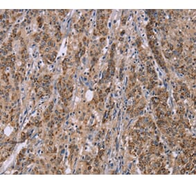 Immunohistochemistry - IFNA2 Antibody from Signalway Antibody (37642) - Antibodies.com