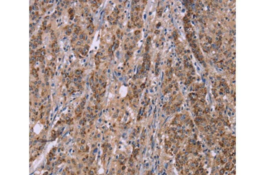 Immunohistochemistry - IFNA2 Antibody from Signalway Antibody (37642) - Antibodies.com