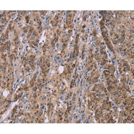 Immunohistochemistry - IFNA2 Antibody from Signalway Antibody (37642) - Antibodies.com