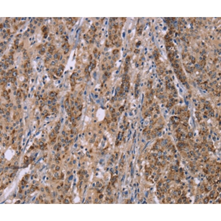 Immunohistochemistry - IFNA2 Antibody from Signalway Antibody (37642) - Antibodies.com