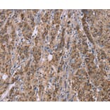 Immunohistochemistry - IFNA2 Antibody from Signalway Antibody (37642) - Antibodies.com