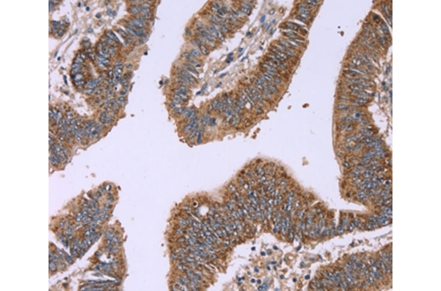 Immunohistochemistry - IFNA2 Antibody from Signalway Antibody (37642) - Antibodies.com