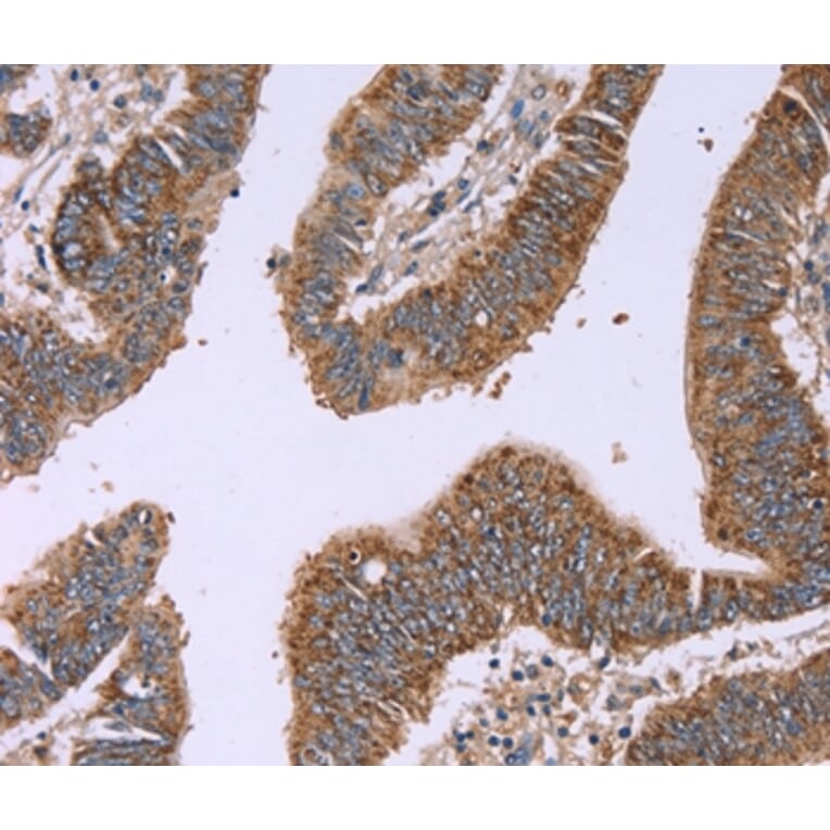 Immunohistochemistry - IFNA2 Antibody from Signalway Antibody (37642) - Antibodies.com